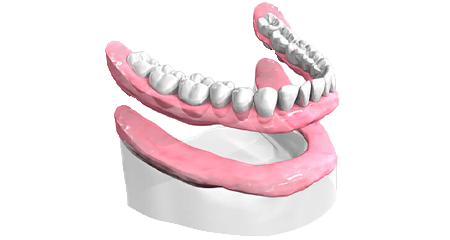 Remplacement dents - Cabinet dentaire Drs Damiani et Richelme - Dentiste Marseille